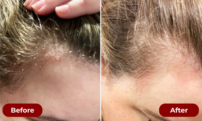 TruGrowth 3-in-1 Scalp Therapy Brush