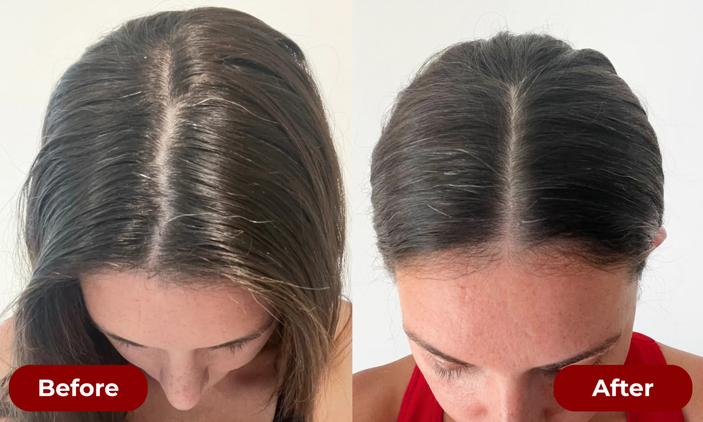 TruGrowth 3-in-1 Scalp Therapy Brush