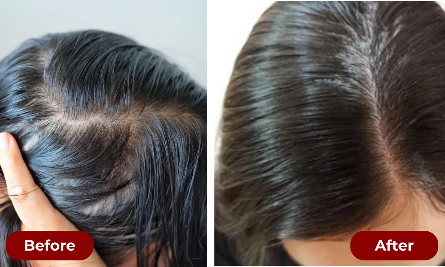 TruGrowth 3-in-1 Scalp Therapy Brush