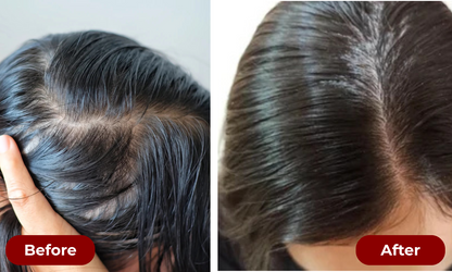 TruGrowth 3-in-1 Scalp Therapy Brush