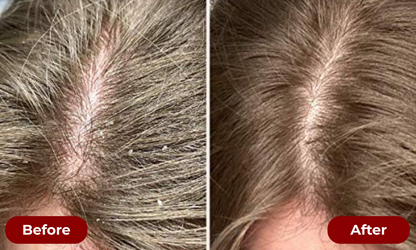 TruGrowth 3-in-1 Scalp Therapy Brush